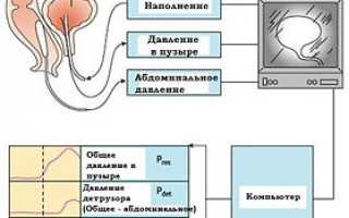 Комплексное уродинамическое исследование КУДИ
