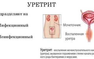 Урология зуд и покраснение