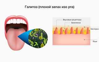 У ребенка запах мочи изо рта причины — Болезни полости рта