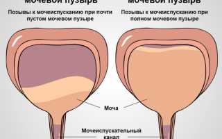 Как лечить гиперактивный мочевой пузырь у мужчин?