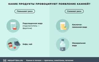 Как вывести камень в мочеточнике в домашних условиях : симптомы и лечение
