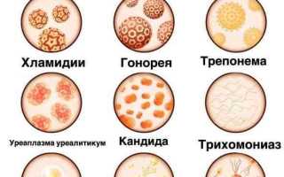 Гинекологические и урологические заболевания