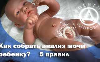 Как правильно надеть мочеприемник девочке видео?