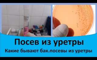 Бак посевы в урологии