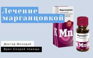 Лечение марганцовкой — что нужно знать