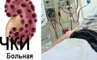 Лечение хпн в россии