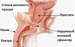 Недержание мочи у мужчин после 50, 60, 70 лет: причины и лечение