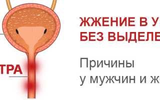 Жжение после мочеиспускания у мужчин «Venerolog.su»