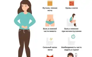 Боли при цистите у женщин