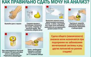 Как сделать чтобы анализ мочи был плохим?