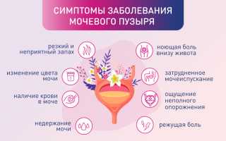 Болезни мочевого пузыря у женщин — симптомы и лечение болезни. Кишечник давит на мочевой пузырь у женщин
