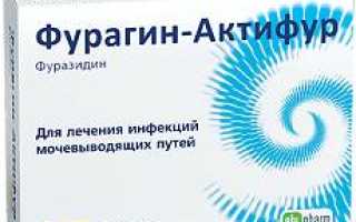 Антибиотики при уретрите у мужчин — Почки